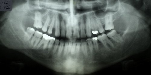 xray teeth.jpg